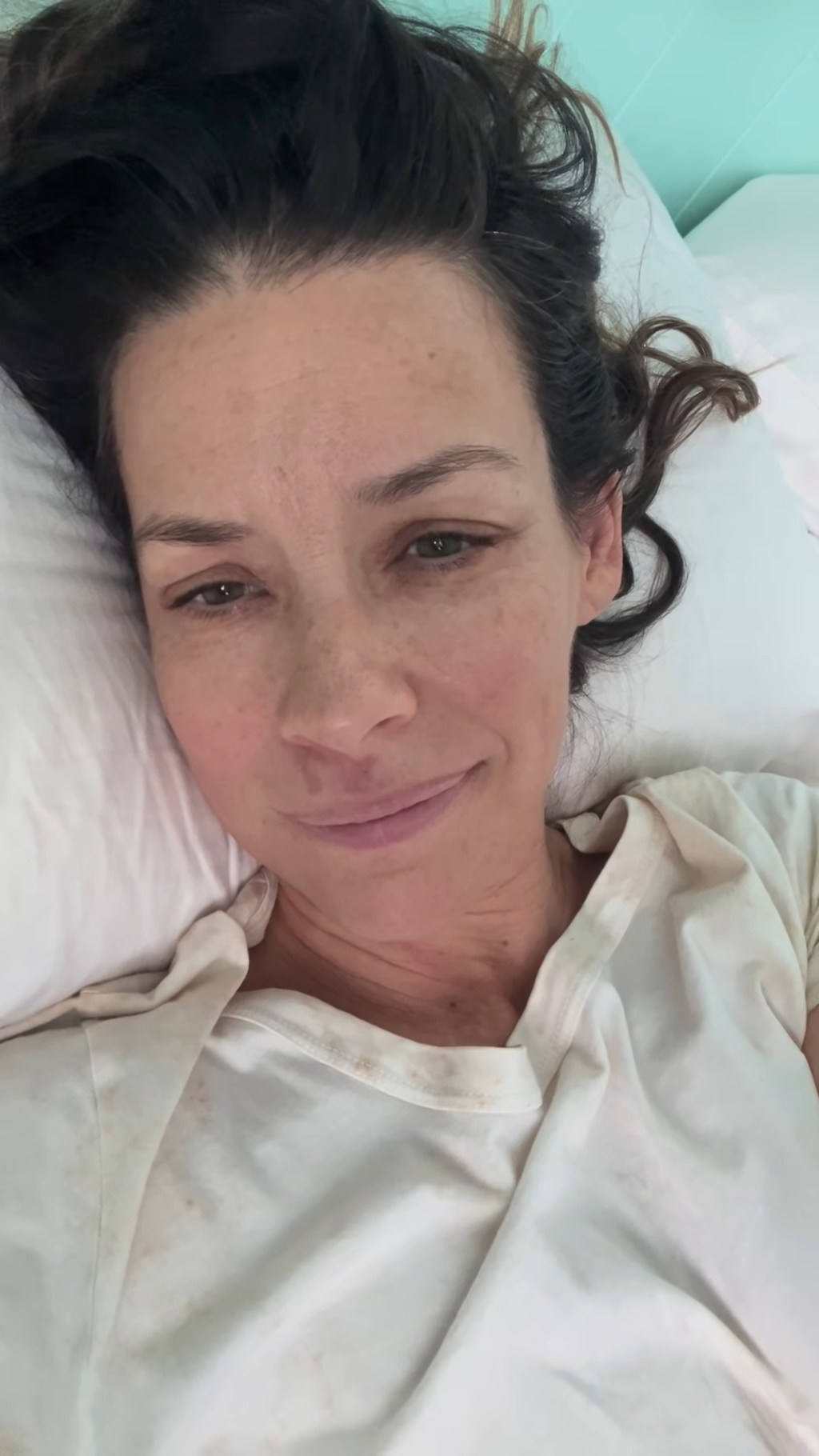AA1TwalQ Evangeline Lilly's Devastating Brain Injury After Rocky Fall