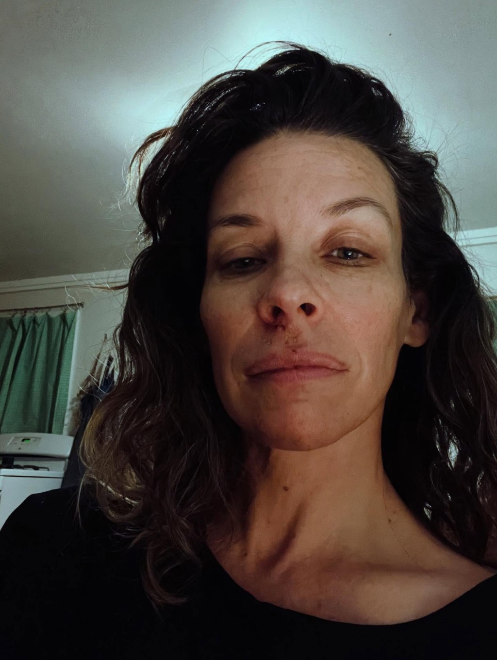 AA1Twd5E Evangeline Lilly's Devastating Brain Injury After Rocky Fall