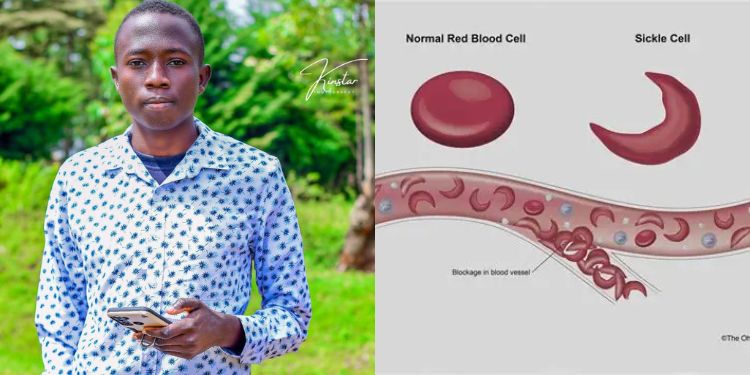 I was diagnosed at 3 months, sickle cell warrior Ekaya Duncan shares lifelong battle with the condition<br>