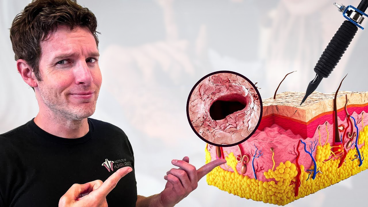 The science of ink: How tattoos affect dermal health<br><br>