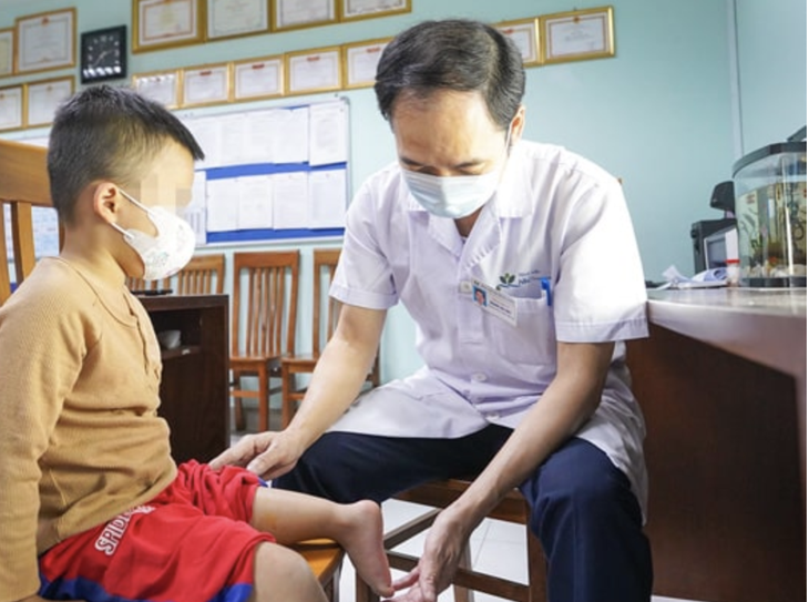Xoay cẳng chân 180 độ, bác sĩ Việt tạo khớp gối mới cho bé trai 5 tuổi