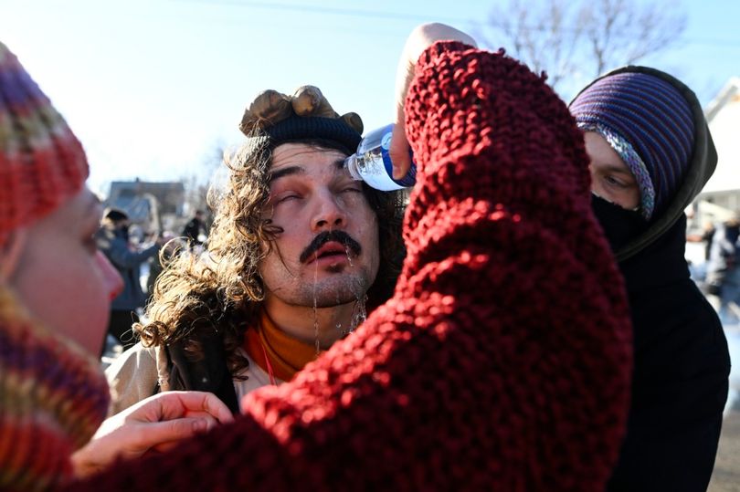 Breaking: Moment distressed ICE protester has water poured in his eyes ...