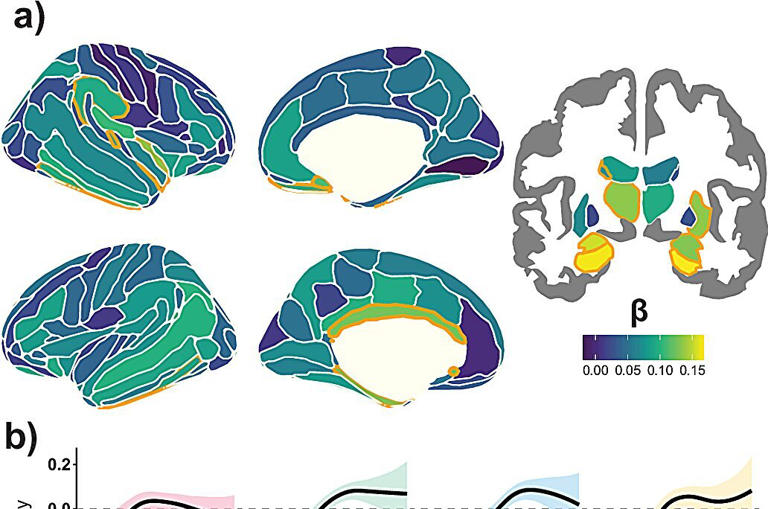 Mega-analysis links widespread brain shrinkage to memory decline in aging
