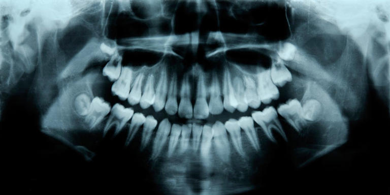 Scientists found an unexpected sign of human longevity—our teeth
