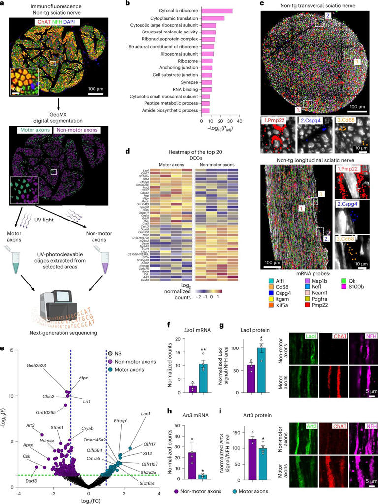 A closer look at how local protein production is altered in ALS