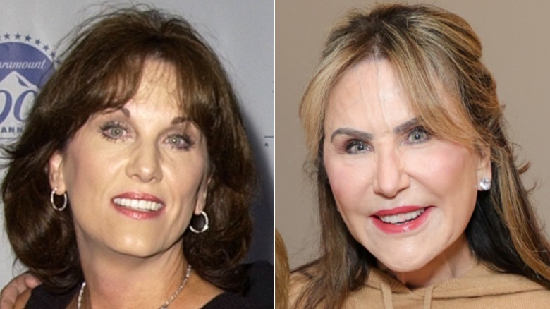 Before & after pics of Dr. Phil's wife show how plastic surgery changed ...