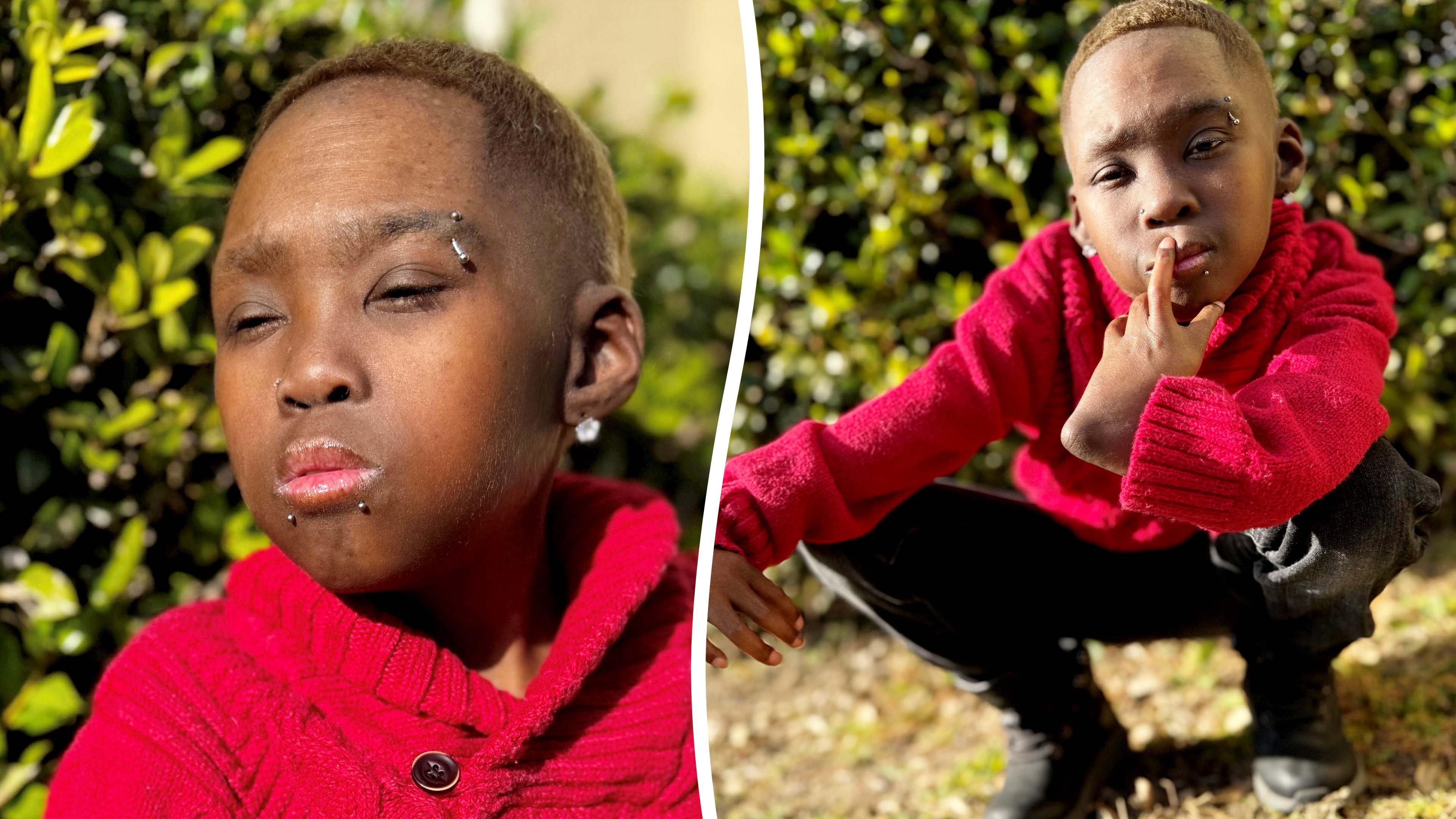 I'm 26 but look like a child because of my rare genetic disorder