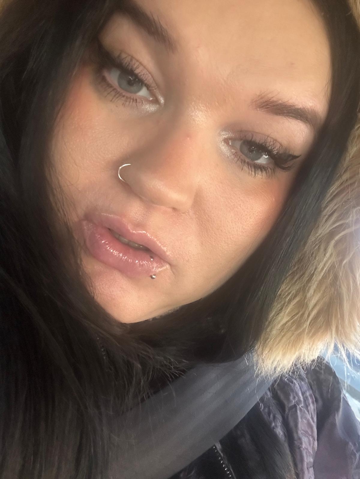 ‘Like Jesy Nelson’s twins, I have SMA. I still live a full life’