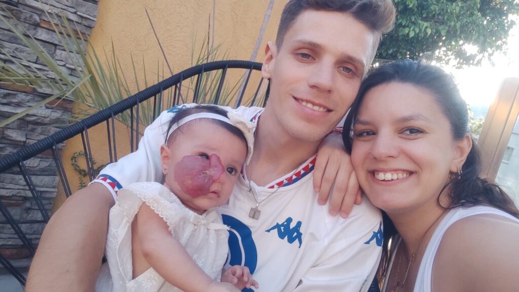 Tiny baby’s tumour was so large it moved her nose