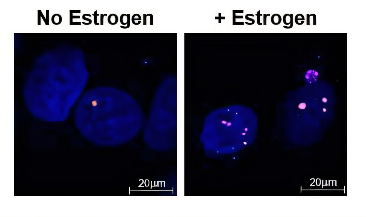 Super-enhancers in cancer cells trigger DNA breaks and error-prone ...