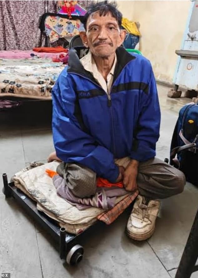 Officials helped a beggar with leprosy off the streets in India only to discover he owns three properties, a car and auto rickshaws that he rents out for income
