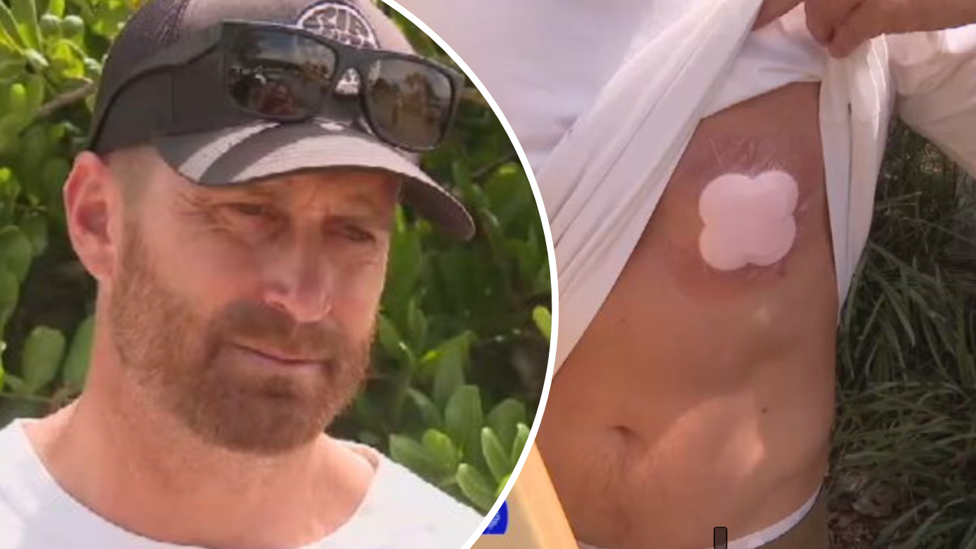 Paul Zvirzdinas was attacked by a shark at Point Plomer on the NSW Mid North Coast.