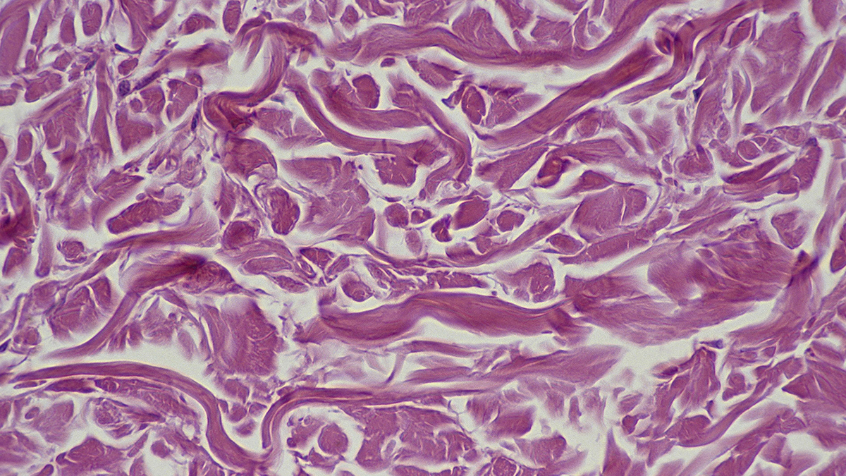 Scientists may have found a blueprint to revive old cells