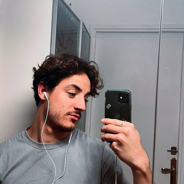 Mathieu had travelled to Turkey for a beard transplant