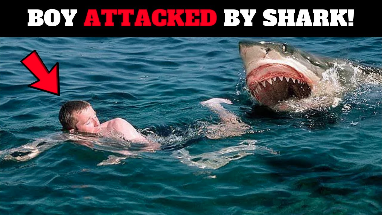 12-year-old injured in shark attack as authorities close nearby beaches