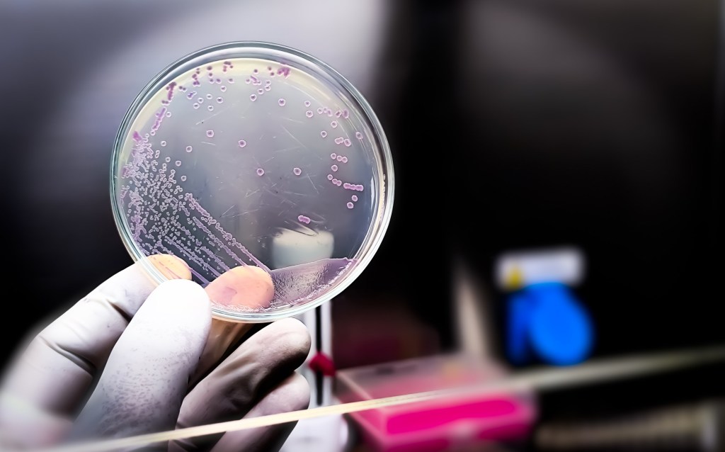 New virus with genetic code written by AI is first step towards a lab ...