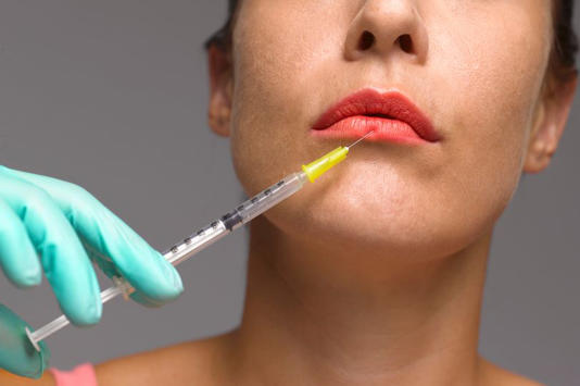 Woman being injected with a needle to her lip