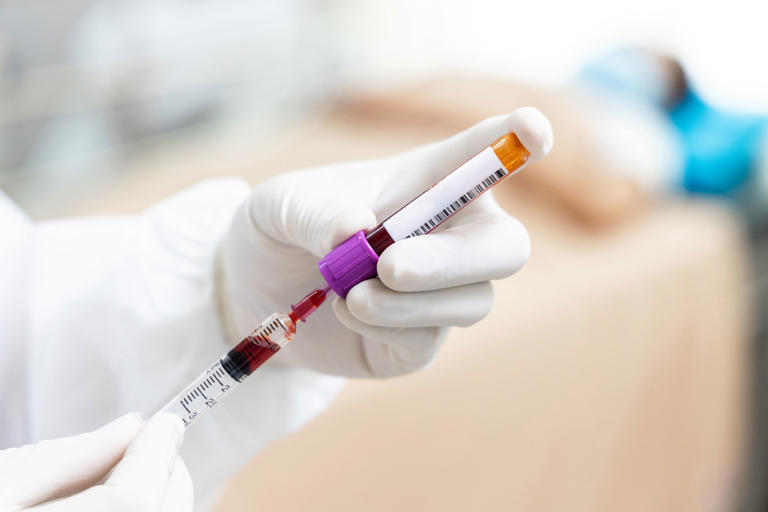 Blood tests vary little without eight-hour fast