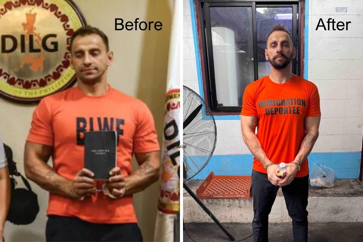 vitaly-zdorovetskiy-news-shocking-transformation-shows-drastic-facial