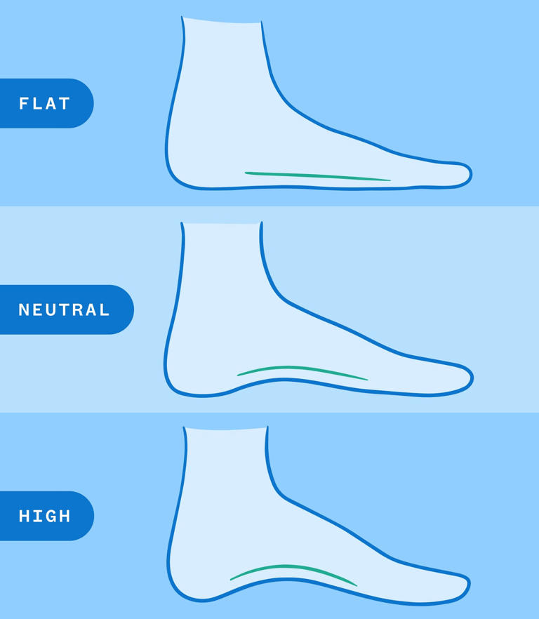 Don’t know your foot arch type? Start here before you buy the wrong shoes
