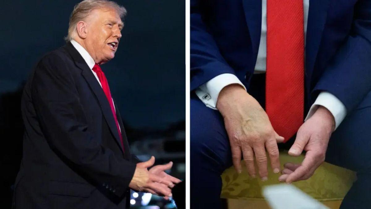 Donald Trump privately suffered a stroke several months ago, claims top ...