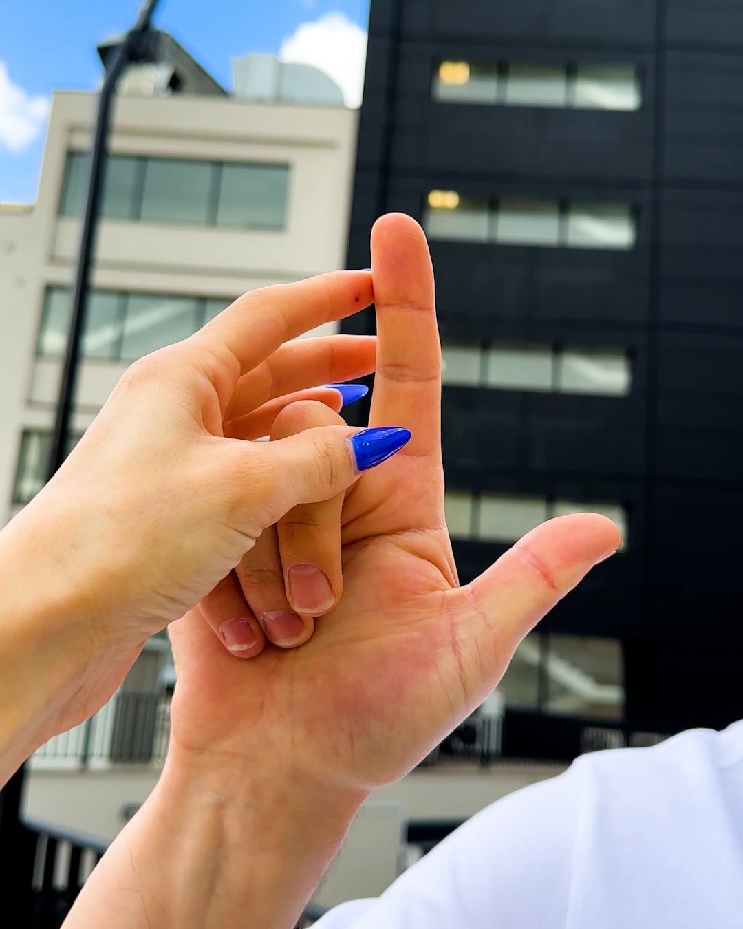 Wait Do I Really Have 11 Fingers