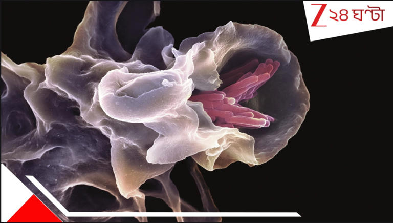 Outbreak Of Victorian Disease: ‘নিপা’ আবহে নয়া যম! এক লপ্তে ৩০০০ আক্রান্ত, রাতারাতি শাটডাউনের সিদ্ধান্ত…