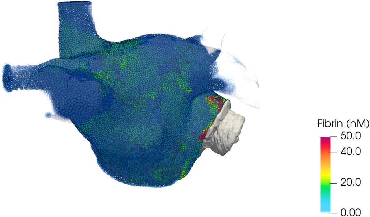 Heart computational model can help doctors operate on and treat ...