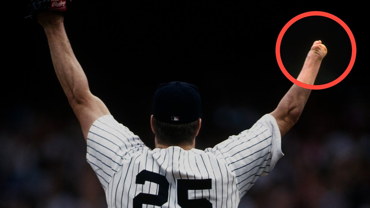 The one-handed MLB legend!