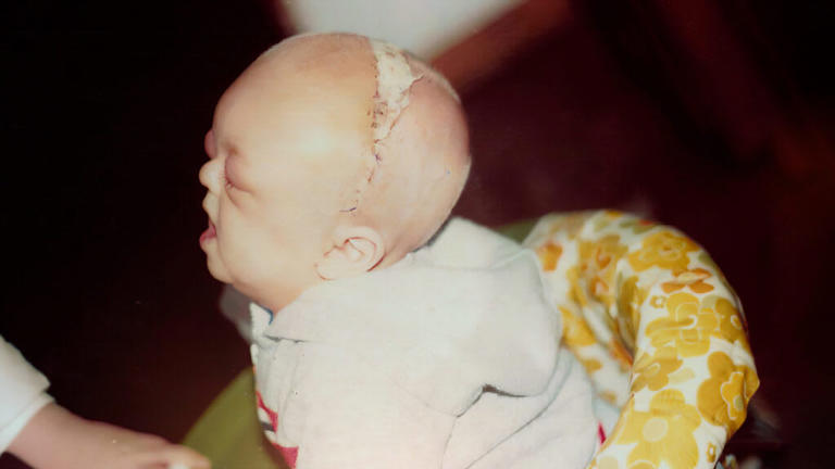 Utah man with rare facial condition sees his life story told on the big ...