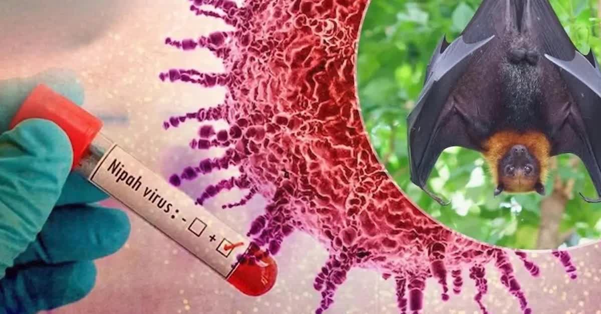 Virus Nipah tại Ấn Độ: Chưa có thuốc điều trị, tỷ lệ tử vong cao và những điều cần biết