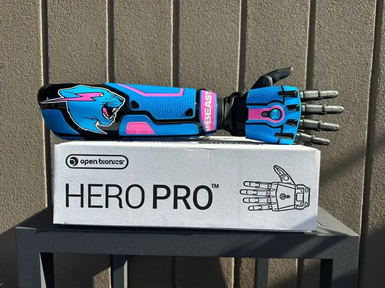 MrBeast surprises 12-year-old Texas boy with custom bionic arm