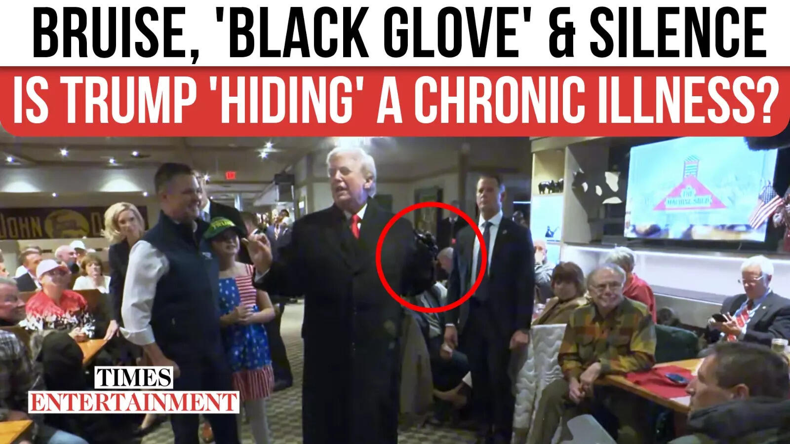 ‘Festering rot’ rumours erupt; Trump’s black glove fuels health questions