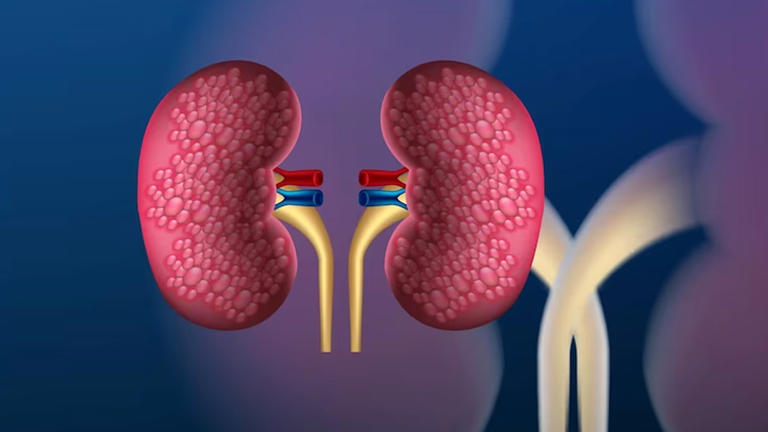 Plant-based proteins may lower the risk of kidney disease, study finds