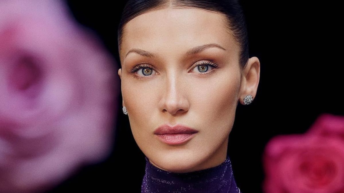 11 celebridades con los síndromes más raros: qué son y cómo cambiaron ...