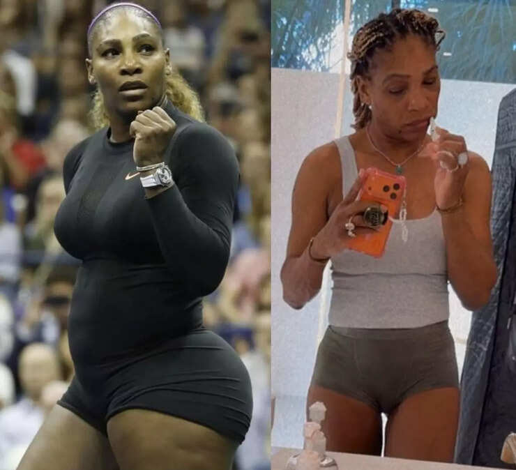 serena williams weight gain Image 1