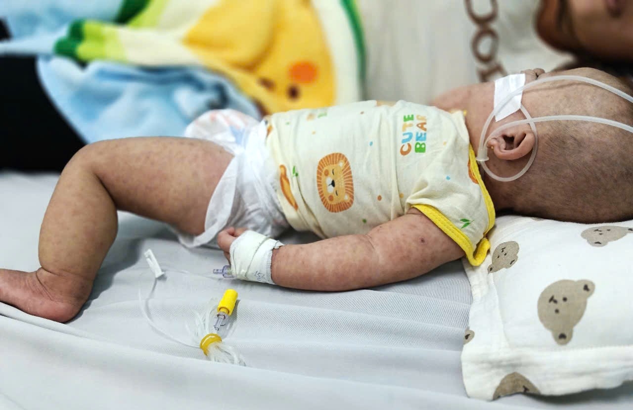 Những bệnh truyền nhiễm dễ mắc dịp Tết