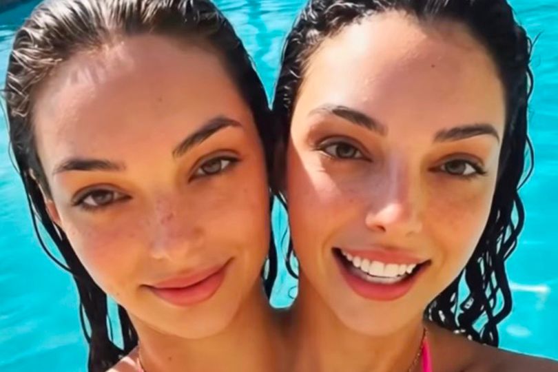 Dark truth behind conjoined twins who post 'hot' bikini photos
