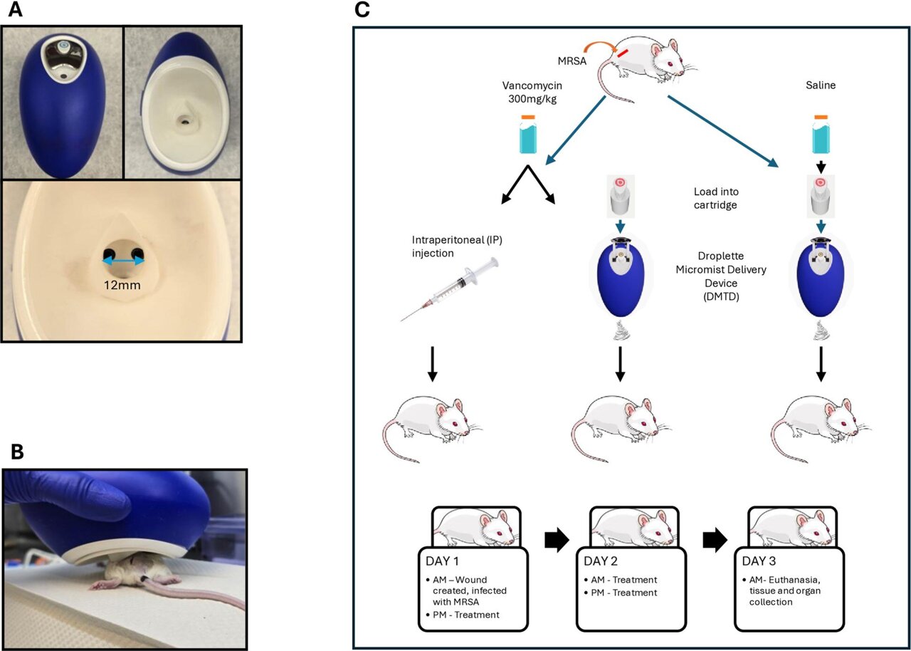 Spray away infections: New device delivers antibiotics via mist ...