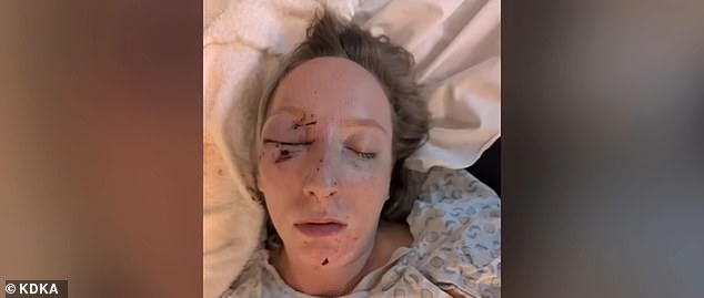 Grace has a doctor's appointment set for Thursday to determine whether surgery will be necessary