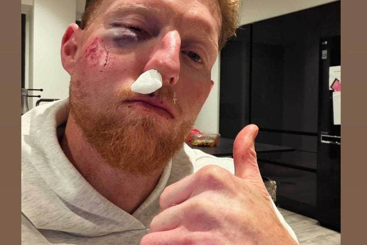 Ben Stokes suffers gruesome facial injury after being struck by a ball<br><br>