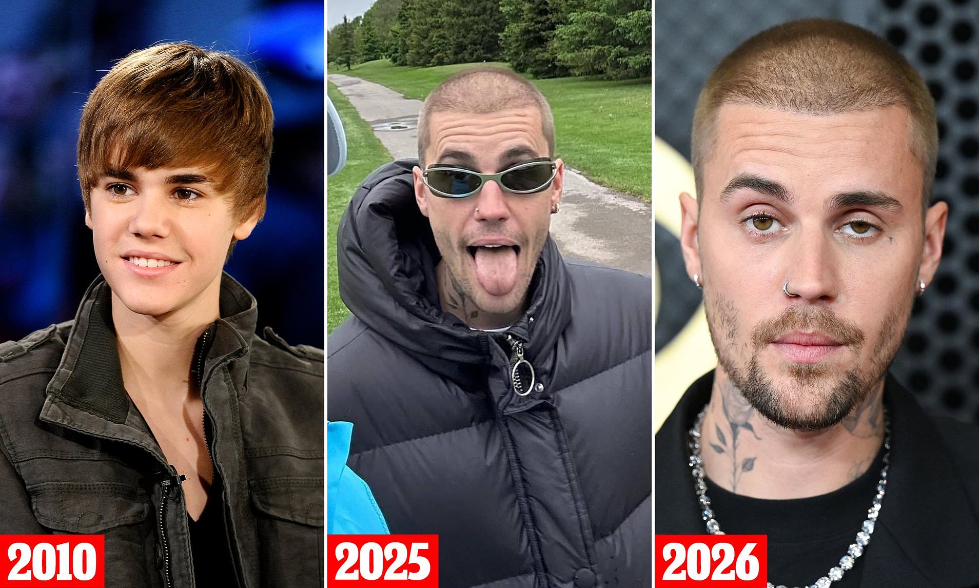 Justin Bieber, 31, engulfed in hair transplant rumors after shocking(01)