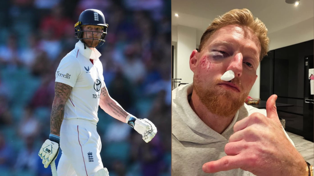 England test captain Ben Stokes left bloodied after brutal facial injury<br><br>