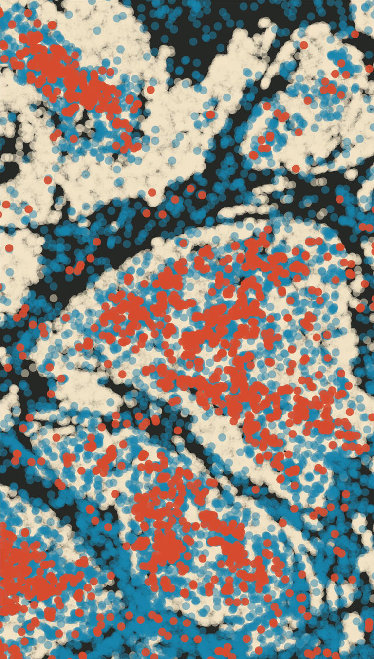 Immune 'hijacking' by tumors can predict cancer evolution