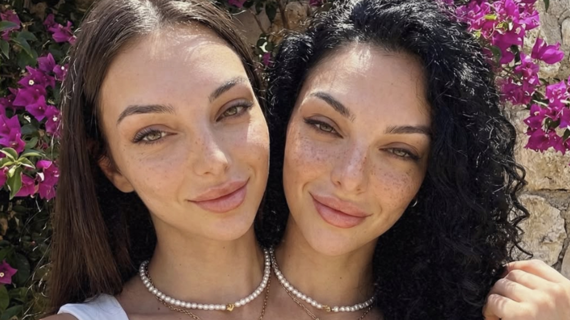 They claim to be conjoined twins, but their success is puzzling