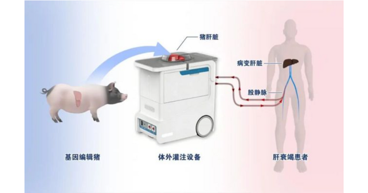 Trung Quốc ứng dụng gan lợn chỉnh sửa gen hỗ trợ điều trị suy gan