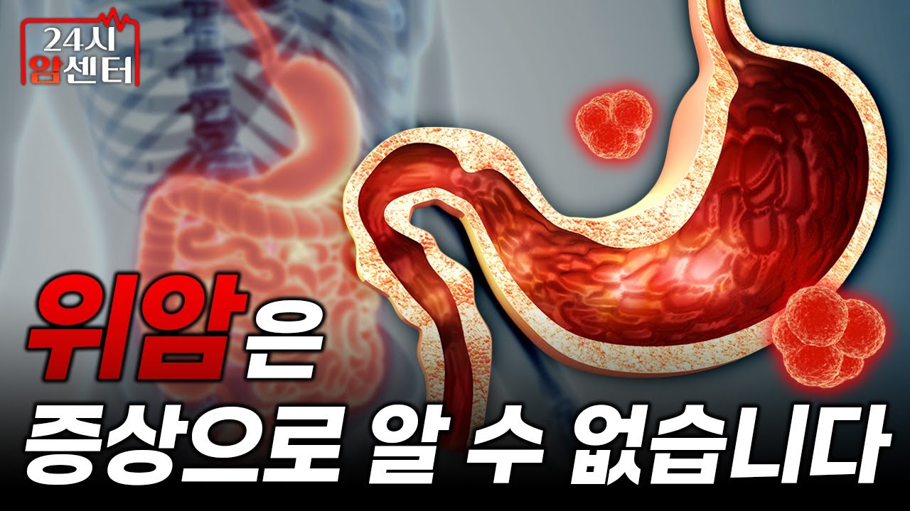 위암, 증상만으로는 절대 알 수 없습니다ㅣ24시 암 센터