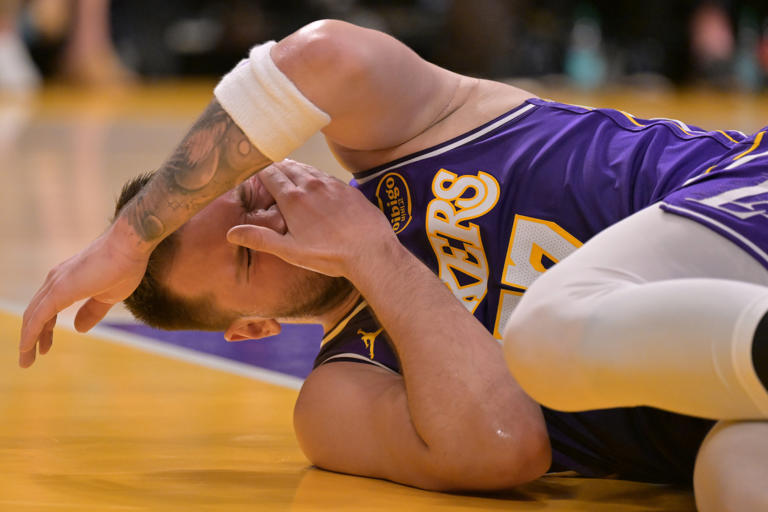 Luka Doncic exits Thursday's game with left leg injury