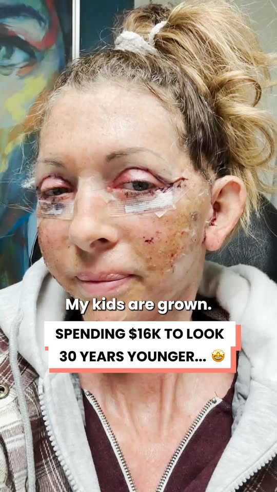 She spent 16,000 to look 30 years younger