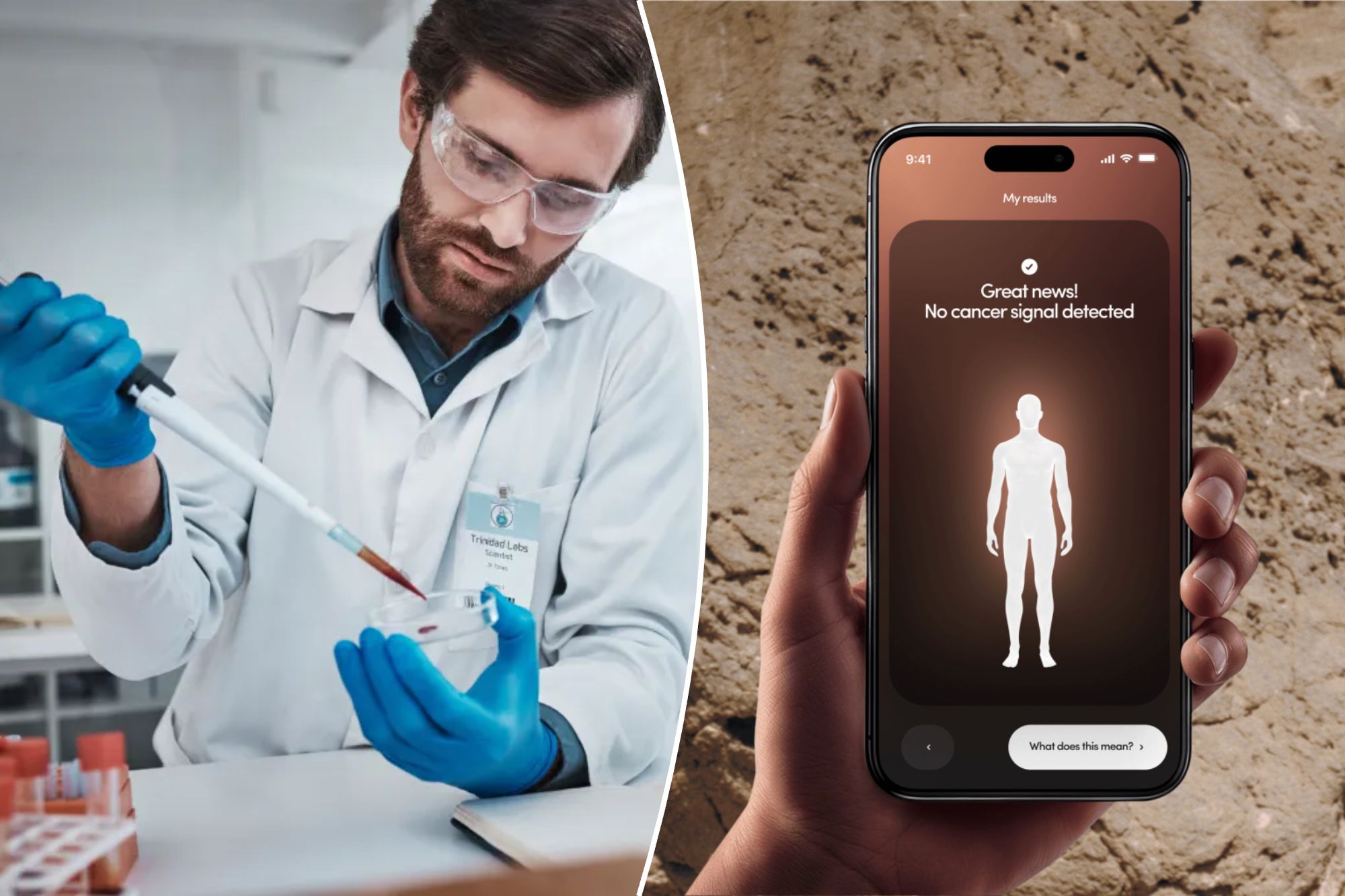 This easy-to-get blood test can help detect cancer before symptoms appear